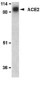 ACE2 / ACE-2 Antibody (N-Terminus)